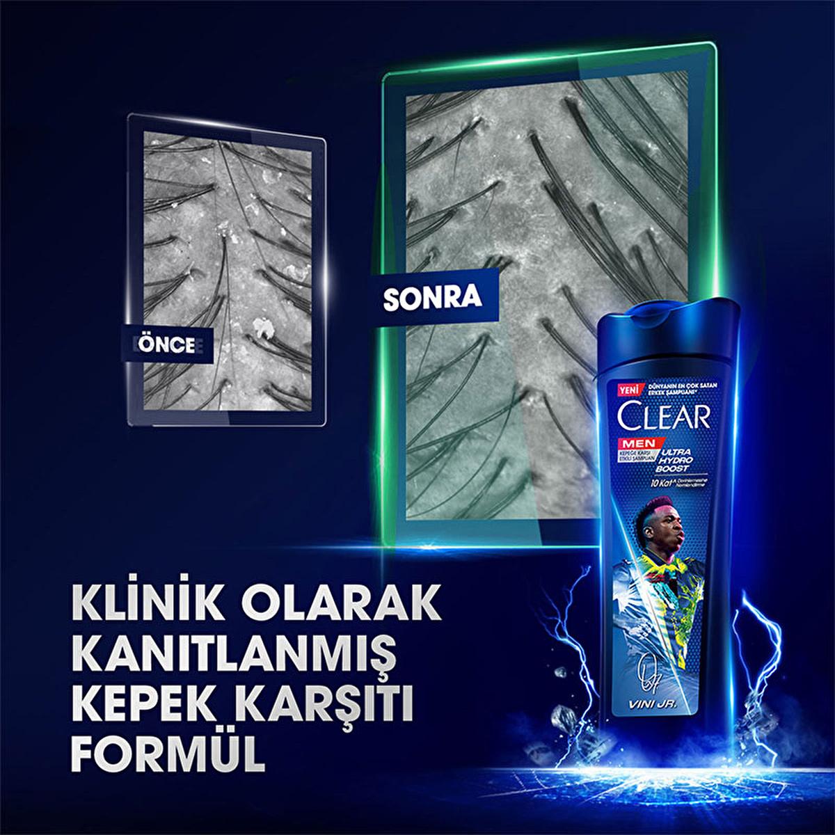 Clear Men Vinicius Junior Ultra Hydro Boost Shampoo - Anti-Dandruff, Moisturizing Shampoo for Men with Cedar Wood & Eucalyptus