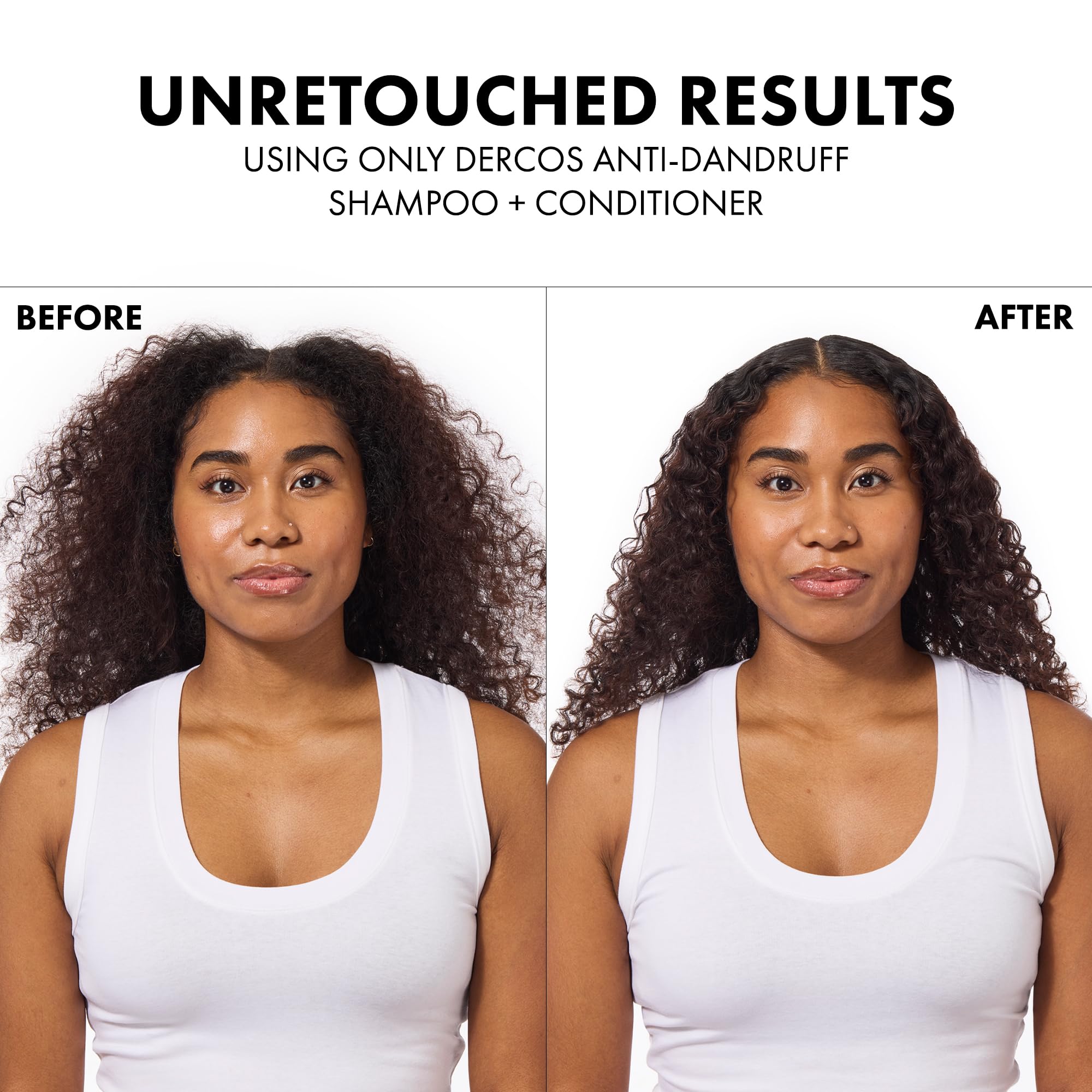 Vichy Dercos Anti-Dandruff Shampoo for Dry Hair - 500ml Refill, Dermatologically Tested, Paraben-Free