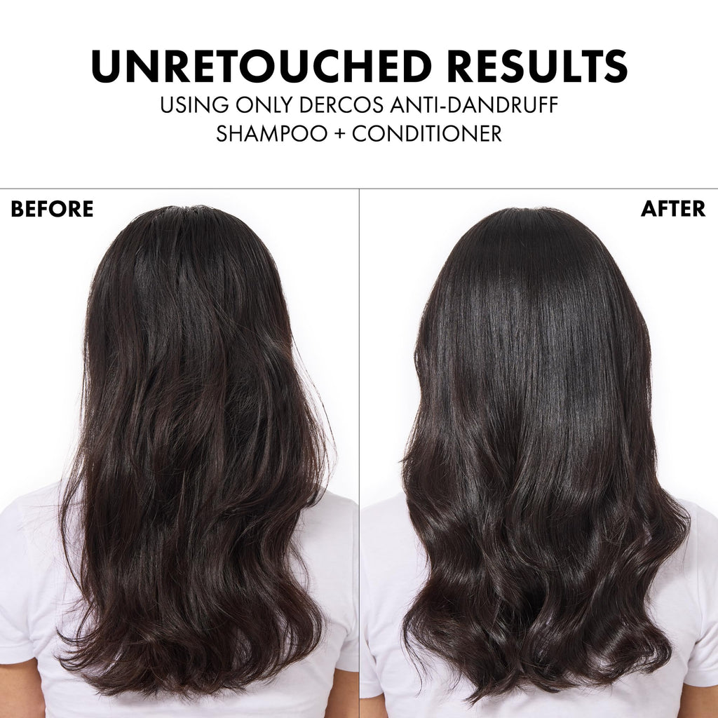 Vichy Dercos Anti-Dandruff Shampoo for Oily Hair - Dermatologically Tested, Selenium Sulfide, 13.20 fl oz